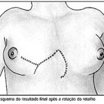 Imagem 2 da galeria