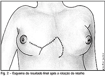 Imagem 2 da galeria