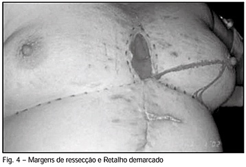 Imagem 4 da galeria