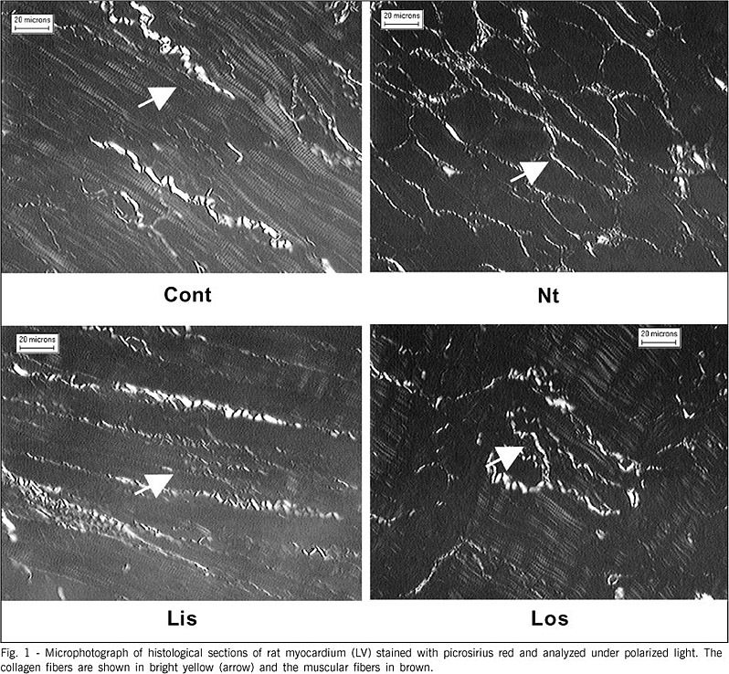 Myocardial remodeling after experimental acute myocardial infarction in rats: effect of renin-angiotensin-aldosterone system blockade