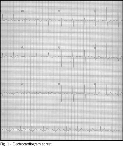 Single coronary artery: angioplasty with stent implantation