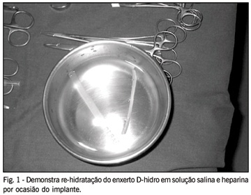 Imagem 1 da galeria