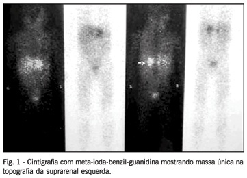 Imagem 1 da galeria