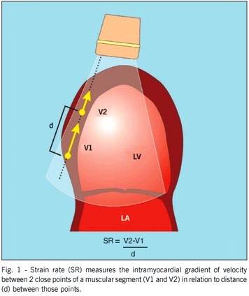 Evaluation of segmentary contractility in Chagas' disease by using the integral of the myocardial velocity gradient (myocardial strain) obtained through tissue Doppler echocardiography