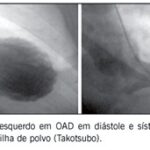 Imagem 4 da galeria