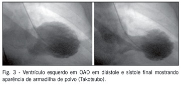 Imagem 4 da galeria