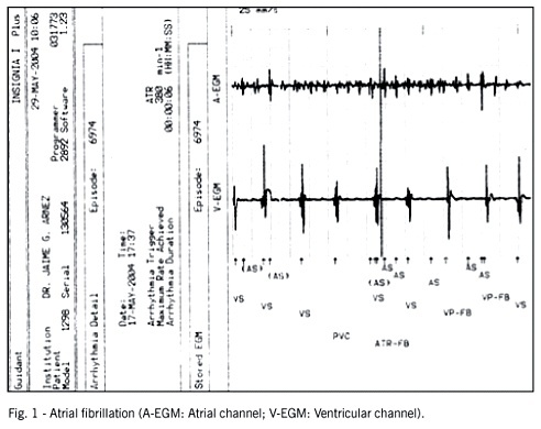 Magnetic resonance imaging in a patient with pacemaker