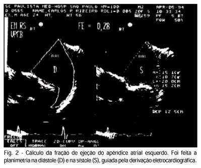 Imagem 2 da galeria