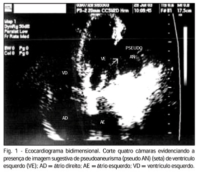 Imagem 1 da galeria