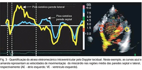 Imagem 3 da galeria