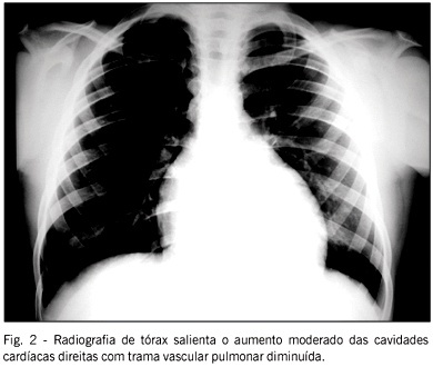 Imagem 2 da galeria