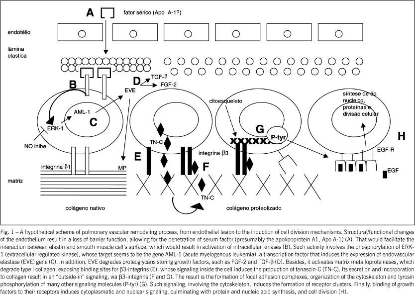 Pulmonary arterial hypertension: physiopathology, genetic aspects and response to the chronic use of sildenafil