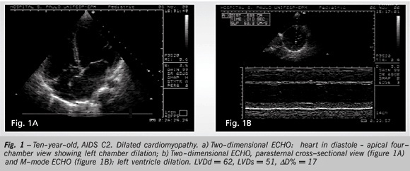 Cardiac longitudinal study of children perinatally exposed to human immunodeficiency virus type 1