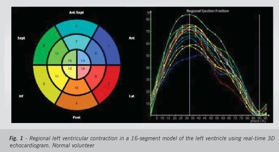 Mechanism of cardiac resynchronization therapy by real-time three-dimensional echocardiography in patients with heart failure