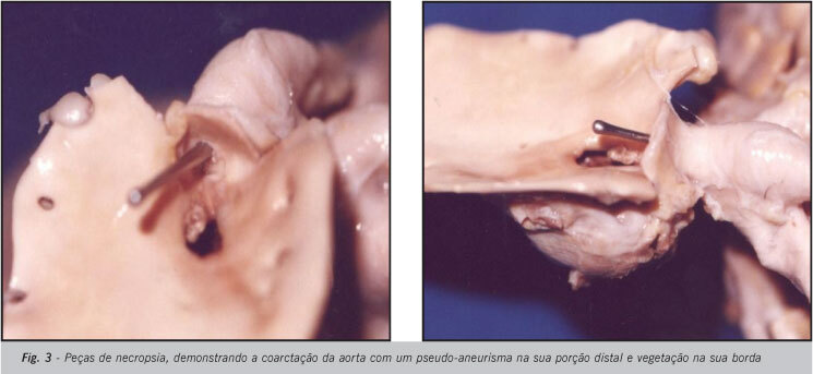 Imagem 2 da galeria