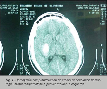 Imagem 1 da galeria