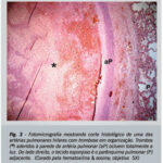 Imagem 3 da galeria