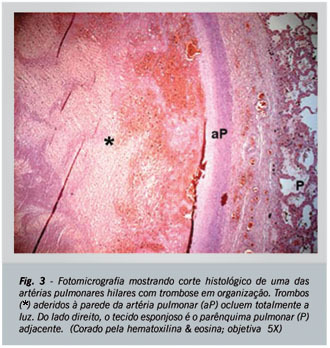 Imagem 3 da galeria