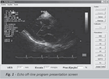 Correlation and concordance between echocardiographic measurements obtained during echocardiography and digitized image measurements: transversal study