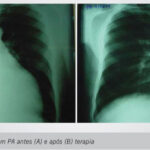 Imagem 1 da galeria