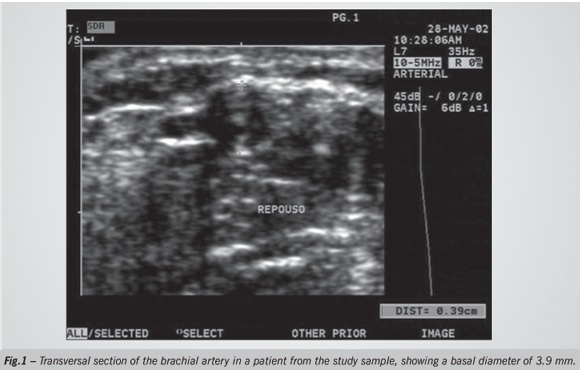 Carotid intimal-medial thickening and endothelial function in coronary artery disease