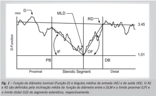 Angiographic geometric predictors of myocardial infarction are not associated with ultrasonographic markers of plaque vulnerability