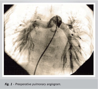 Complete repair in total atrioventricular canal defect with cyanosis