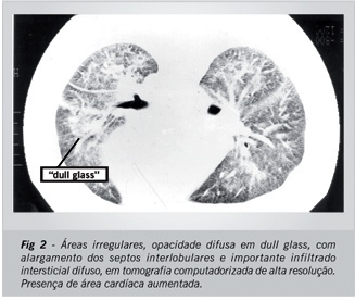 Imagem 2 da galeria