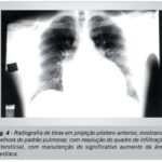 Imagem 4 da galeria
