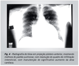 Imagem 4 da galeria