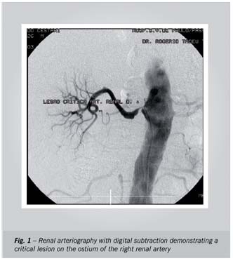 Prevalence of renal artery stenosis in 1,656 patients who have undergone cardiac catheterization