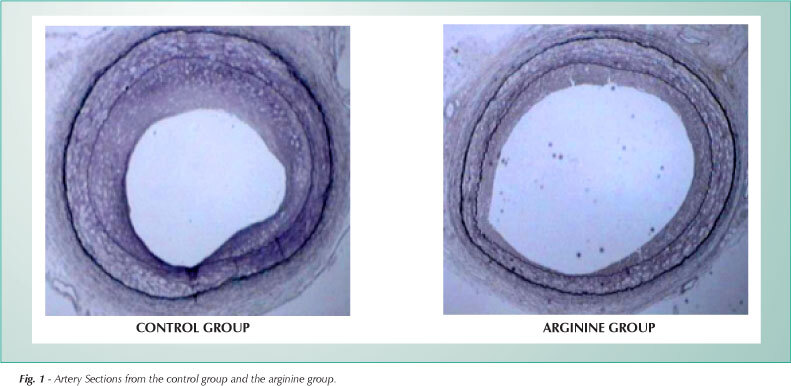 The effect of L-arginine on neointimal proliferation and artery remodeling on an iliac artery lesion caused by a balloon catheter in hypercholesterolemic rabbits