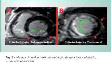 Imagem 2 da galeria