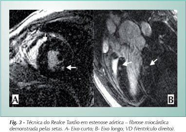 Imagem 3 da galeria