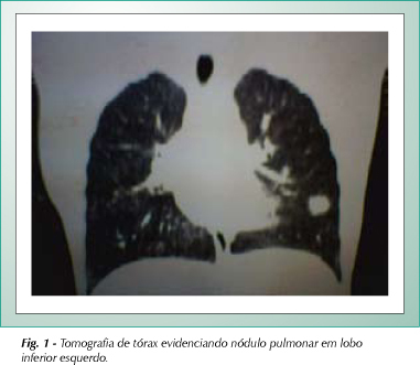 Imagem 1 da galeria