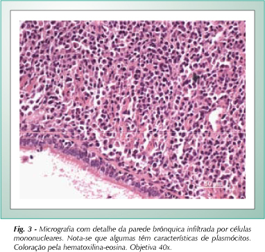 Imagem 3 da galeria