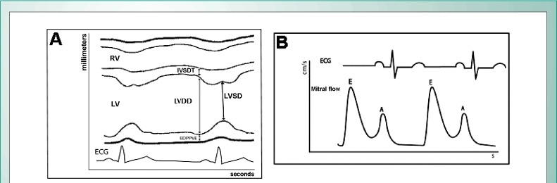 Cardiac morphofunctional injuries in patients with hepatitis C virus: doppler echocardiographic evaluation