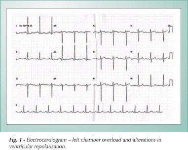 Multivessel percutaneous treatment of Takayasu Arteritis
