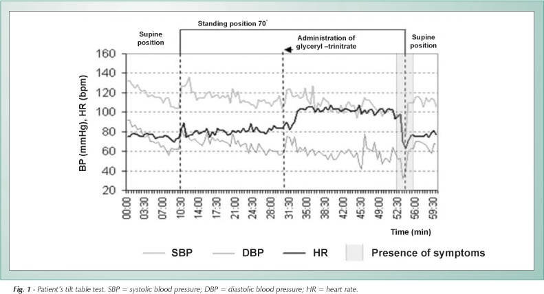 Tilt table test in the differential diagnosis of refractory "epilepsy"