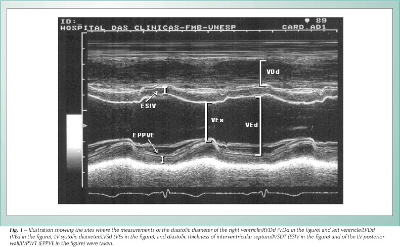 Percentile curves of normal values of echocardiographic measurements in normal children from the central-southern region of the State of São Paulo, Brazil