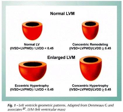 Echocardiography evaluation for asymptomatic patients with severe obesity