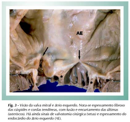Imagem 3 da galeria