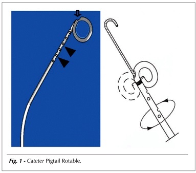 Treatment of massive pulmonary embolism by percutaneous fragmentation of the thrombus