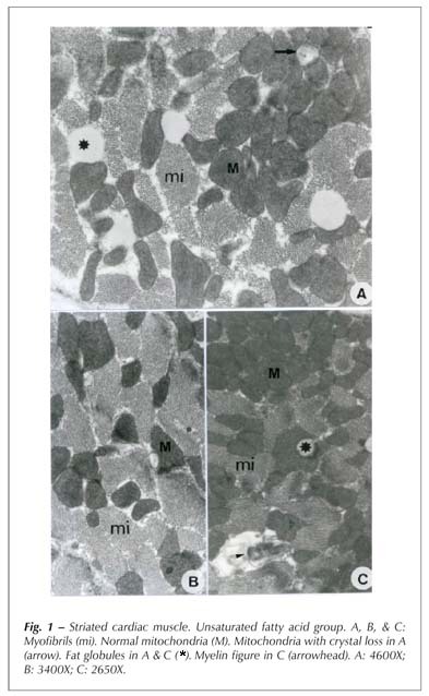 Influences of rich in saturated and unsaturated fatty acids diets in rat myocardium