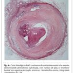 Imagem 4 da galeria