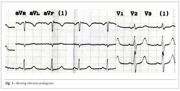 Percutaneous mitral valvuloplastry in a pregnant woman guided only by the transesophageal echocardiography