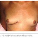 Imagem 1 da galeria