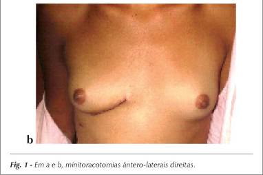 Imagem 1 da galeria