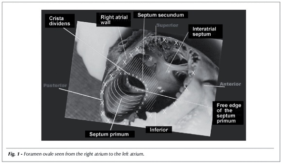 Morphological basis for the study of the interatrial septum in the human fetus