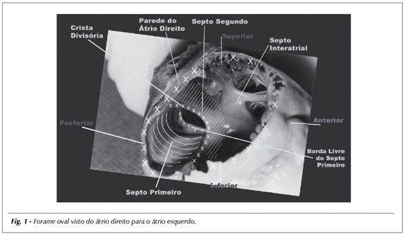 Bases morfológicas para o estudo do septo interatrial no feto humano